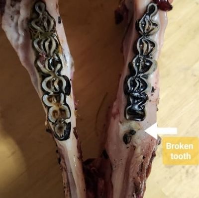 Lower jaw showing a broken molar tooth